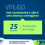 Vitiligo | 25 de junho: Dia Mundial do Vitiligo